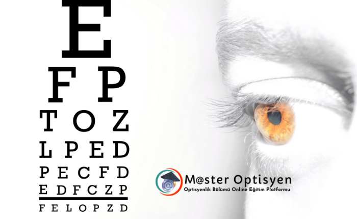 Anizometropi Nedir?